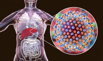 के हो हेपेटाइटिस रोग ? यी हुन् यसका लक्षण र कारण 